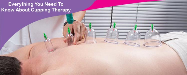 Everything You Need To Know About Cupping Therapy